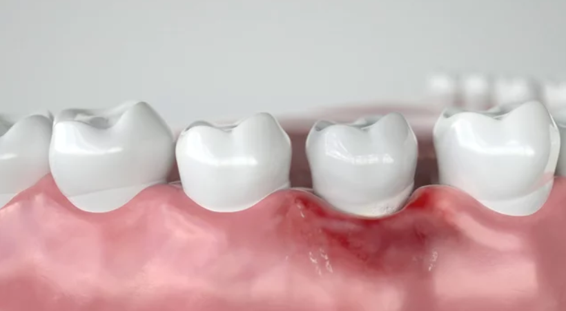 中年男性の歯の健康寿命を守るセルフケア　歯周病や歯槽膿漏を予防し電動歯ブラシやフロスでケアするイメージ